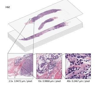 Artificial intelligence reveals features associated with breast cancer neoadjuvant chemotherapy responses from multi-stain histopathologic images.