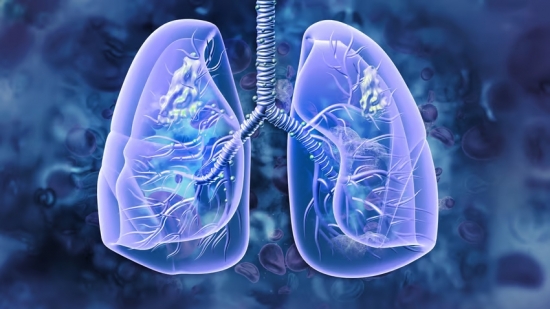 AI-calculated biomarker could predict how lung cancer patients respond to immunotherapy